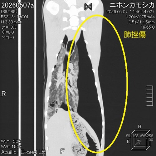 カモシカ02.jpg